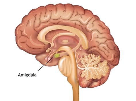 Caseos Amigdala É Normal - Amígdala Grande é Normal - NAZAEDU