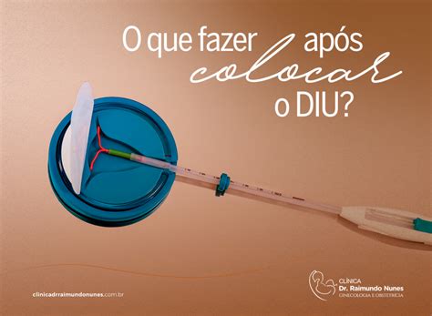 Quantos Dias Depois De Colocar O Diu Pode Ter Relação - Sintomas Após Colocar Diu Mirena - ZULEDU