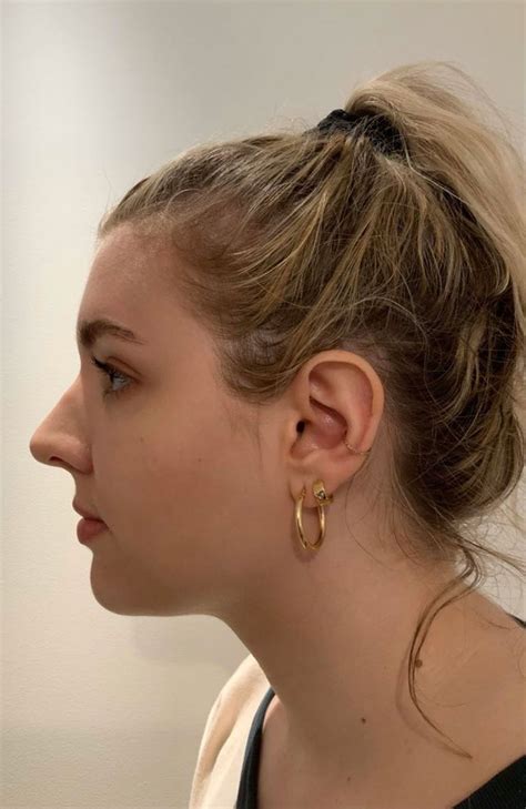 How To Make Nose Look Less Pointy With Makeup - Makeup Vidalondon