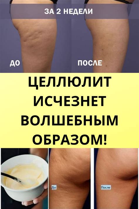 Ухаживаем за собой | Community group, You are invited, Workout