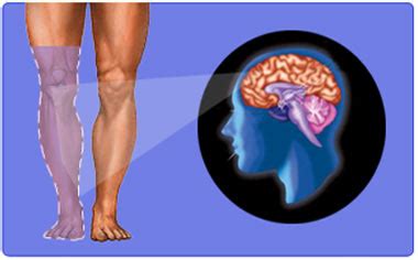 Sindrome Do Membro Fantasma - Síndrome do Membro Fantasma - Conversas de Hipocondríacos - FCiências