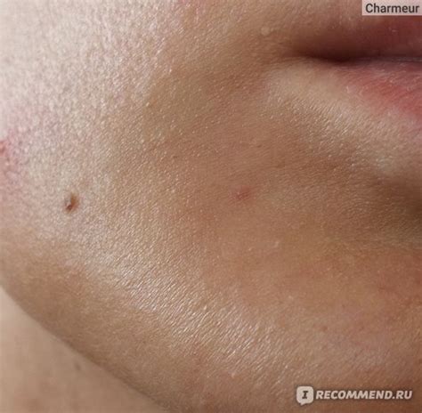 Пилинг - тоник Elizavecca Hell-Pore Clean Up Aha Fruit Toner с ...