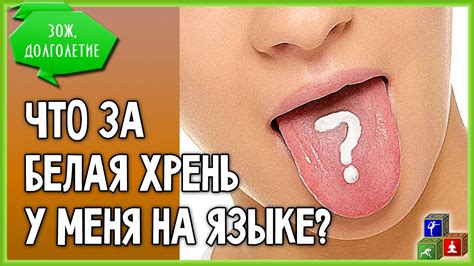 😝 Белый налет на языке? Голодание и причины белого налета. - YouTube
