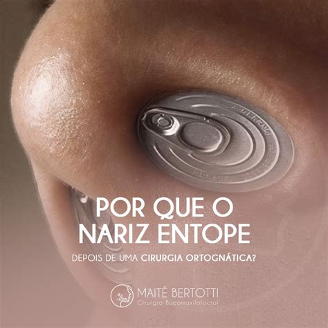 Porque O Nariz Entope - Porque O Pó Entope O Nariz - NAZAEDU