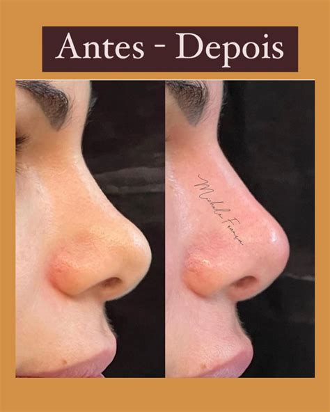 Rayssa Teixeira Melo - Home | Facebook