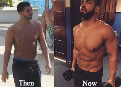 Drake Plastic Surgery Before and After Photos