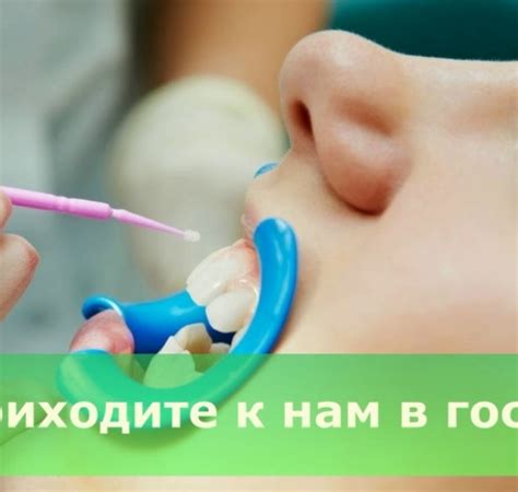 Цена на фторирование зубов Москва