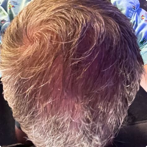 Success Stories - Roots