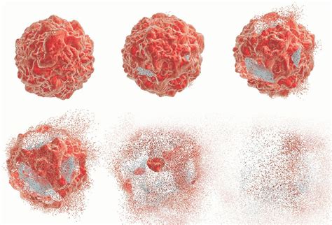 Insights into cell death could inspire disease treatments | Stanford ... 