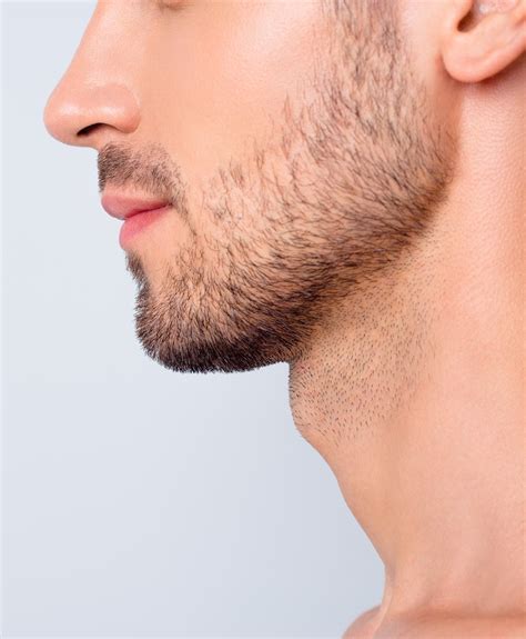 chin augmentation  west palm beach dr patrick cleveland