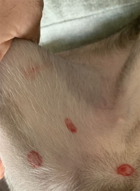 flea bites  dogs belly