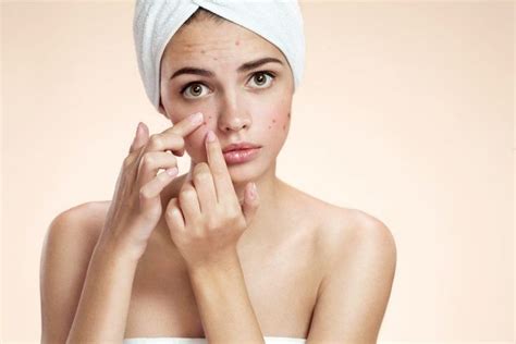 Девушка с прыщами. Косметика от прыщей на лице | Beauty skin care, Skin ...