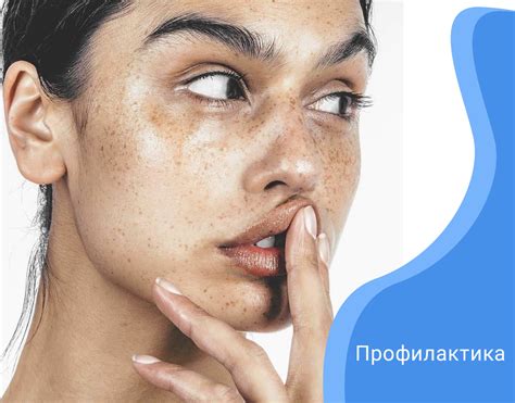 Гиперпигментация кожи лица — что это такое, методики профессионального ...