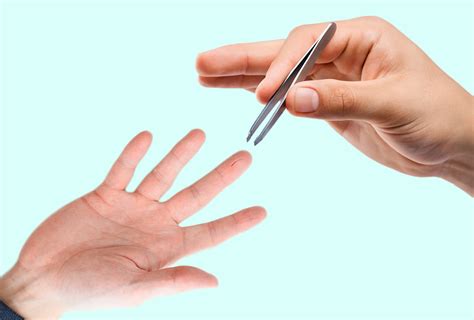 How to Remove Hair Splinters at Home - eMediHealth