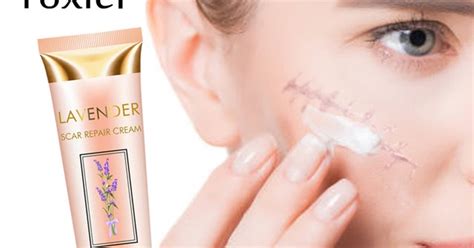 Yoxier Acne Scar Stretch Marks Remover Cream Repair Face Cream Skin ...