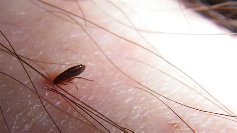 Can Fleas Live On Humans? - How To Avoid Fleas Crawling On Your Skin ...