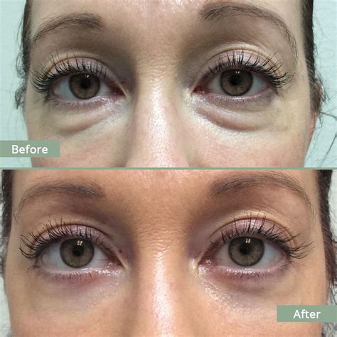 Souirensu It Works: The Celebrity Secret to [Desired Outcome] - lp2jfuj