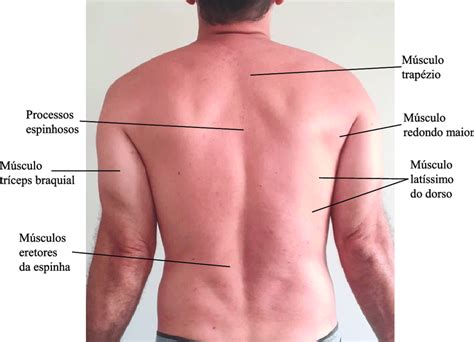 Regiao Dorsal Onde Fica