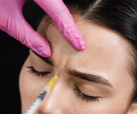 botox treatment   philippines glamer aesthetics glamer aesthetics