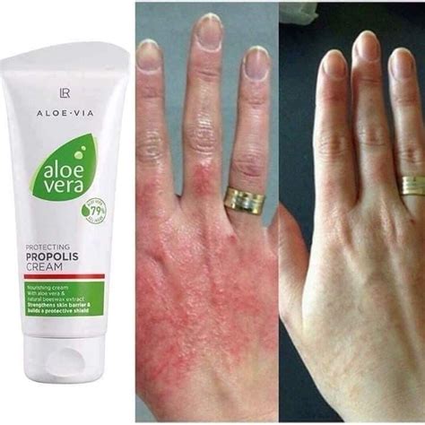 LR Health & Beauty - 🤚LR Крем Алое Вера с Прополис за Напукани Ръце и ...