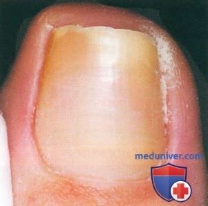 Серия фотографий №5: экстремальные случаи из подологической практики