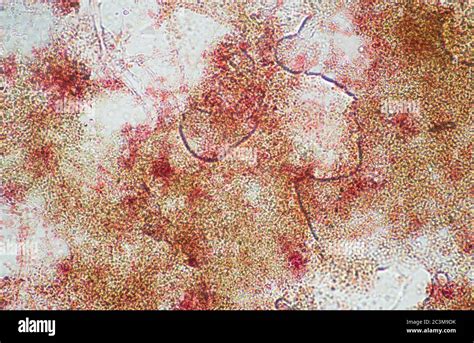 Penicillium, microscope view Stock Photo - Alamy