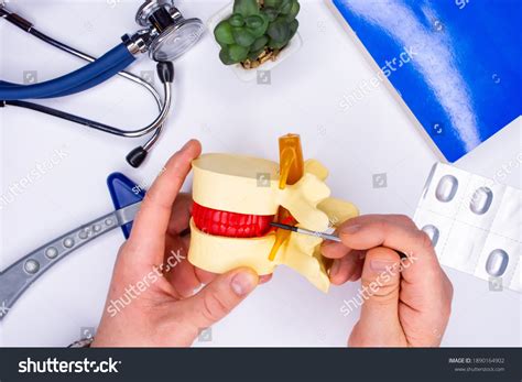 Back Pain Diagnosis Treatment Concept Photo Stock Photo 1890164902 ...