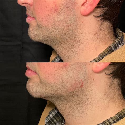 Gallatin - Smiley Aesthetics