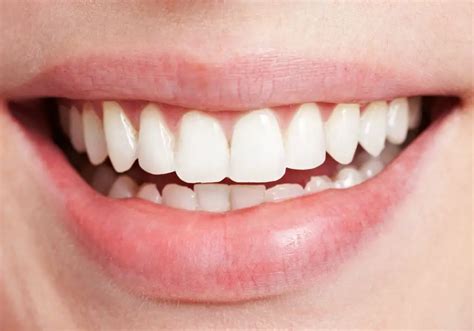 americans  white teeth intertwining factors