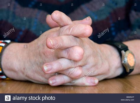 missing fingers stock  missing fingers stock images alamy