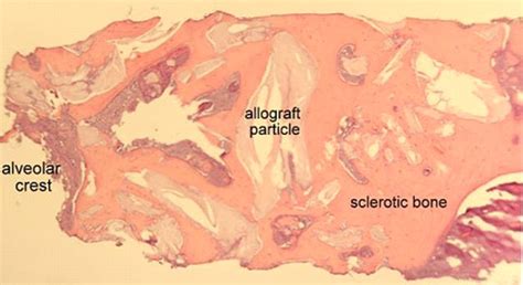 allograft histology steinerbio