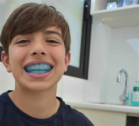 Myobrace Malaysia: A Full Guide on Children’s Braces Alternative