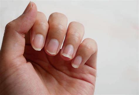 lunula   nails    health