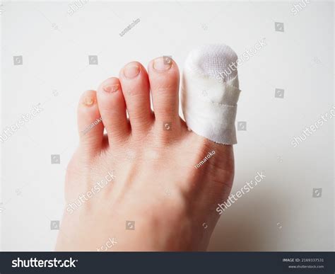 46 Taping Toenail Images, Stock Photos, 3D objects, & Vectors ...