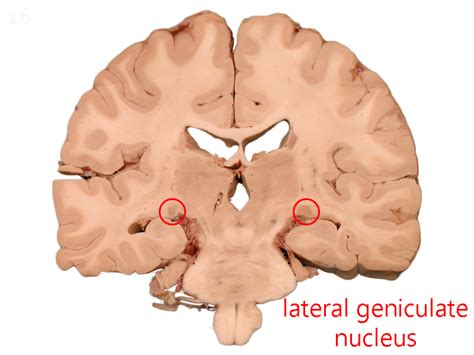 Lateral Geniculate Nucleus (LGN) – Introduction to Neuroscience