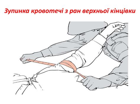 Загальні положення надання домедичної допомоги у секторі обстрілу ...