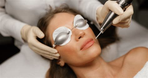 laser treatment  pigmentation removal lumine dermatology