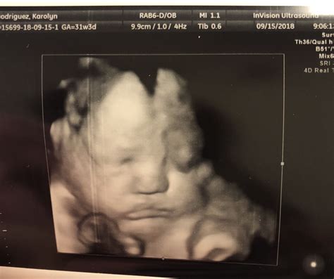 39 Weeks Pregnant 3d Ultrasound