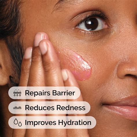 soothing barrier support serum  ordinary