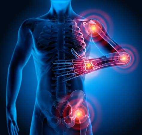 Joint Pain Treatment | Albany, NY | Capital District Interventional