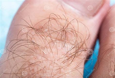 Hair on a Toe of a Man, Macro. Hygiene Concept for Hair Removal ...