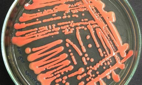 New fungus that can infect humans is discovered in China