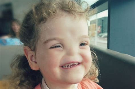 The birth of a girl without a nose shocked the whole world: but she ...