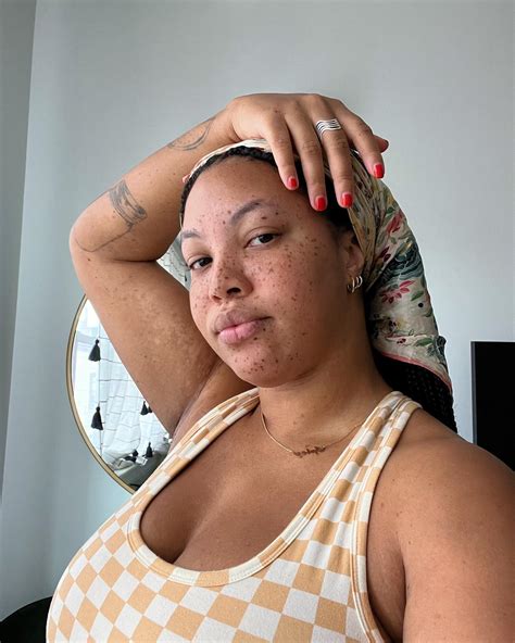 Why the lemonia formula is better for sensitive skin types 1