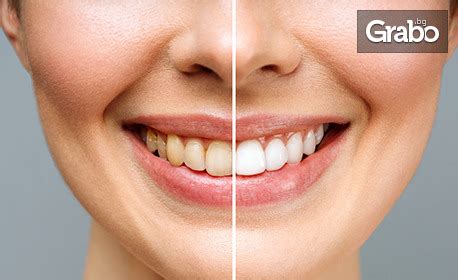 Кабинетно избелване на зъби с Pure Whitening System, почистване на ...
