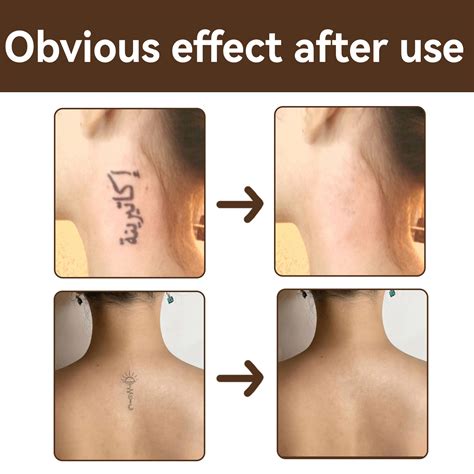 cover to tattoo scar birthmark spots waterproof and brightening