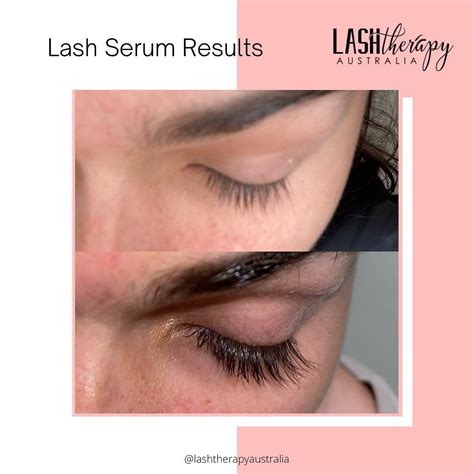 lash serum results    eyelash serum lash serum eyelash