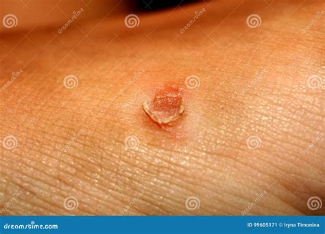 corn   skin  corn popped stock image image  barefoot