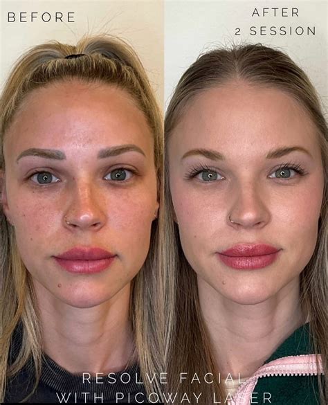 microblading   works pros cons daela