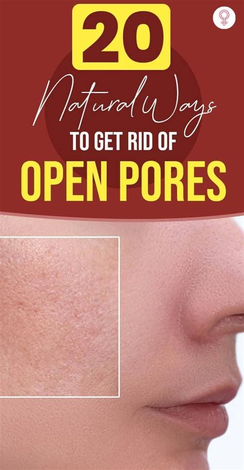 how to get rid of open pores